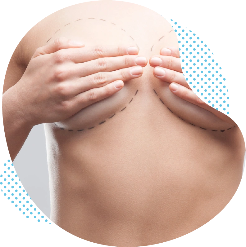 Votre réduction mammaire – réalisée de manière professionnelle par des chirurgiens esthétiques en Turquie