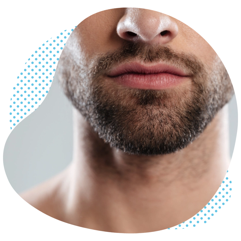 La greffe de la barbe en Turquie