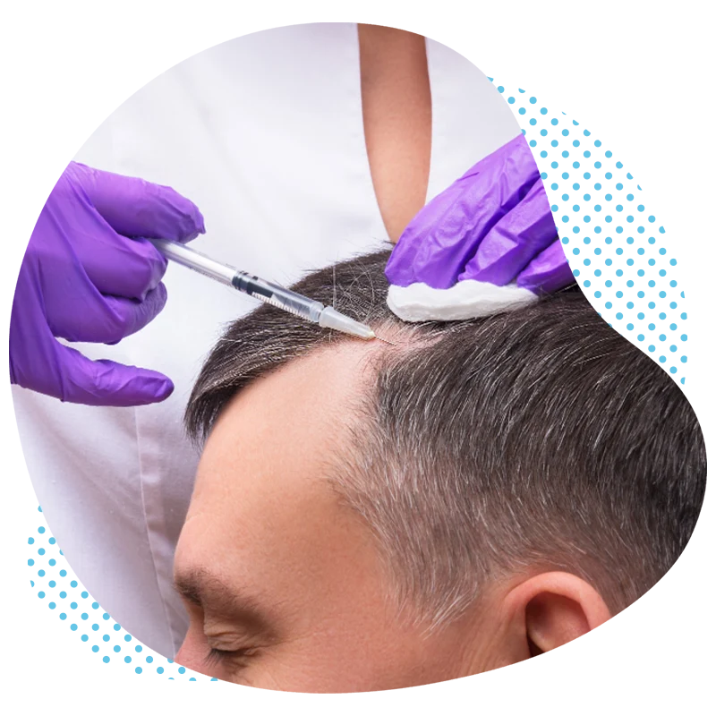 Comment fonctionne une greffe de cheveux DHI ?