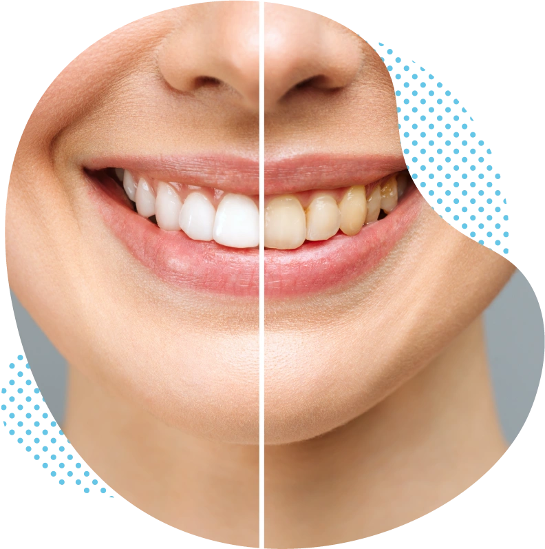 Types de traitements orthodontiques en Turquie