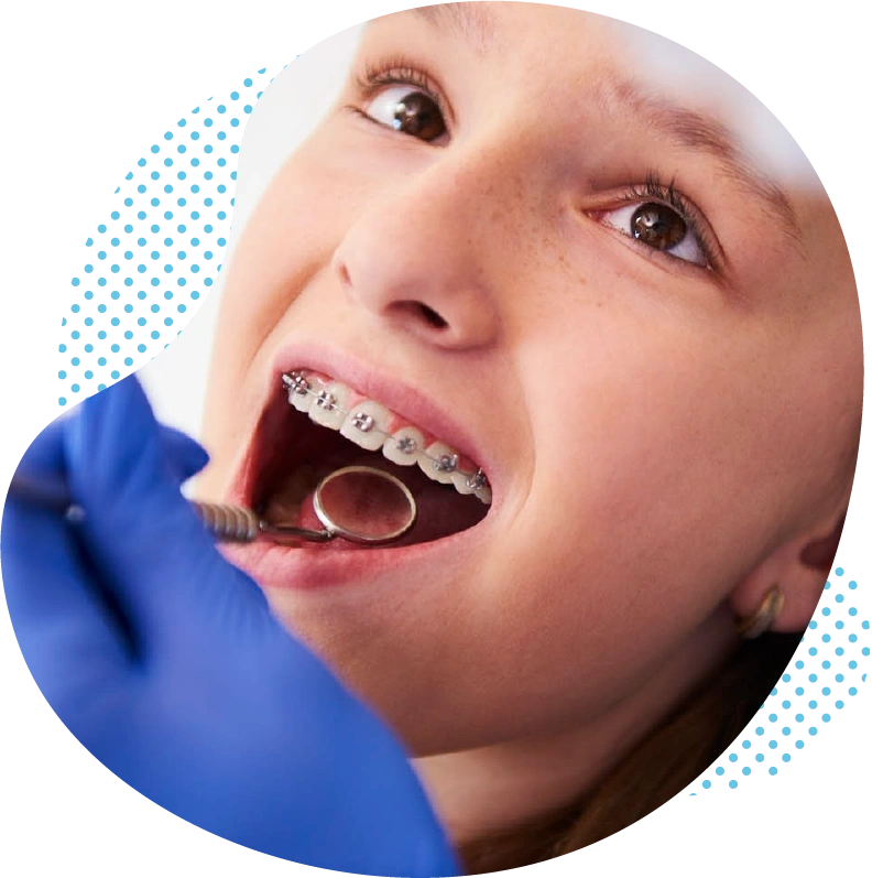 Nous vous proposons les prestations d’orthodontie suivantes en Turquie :