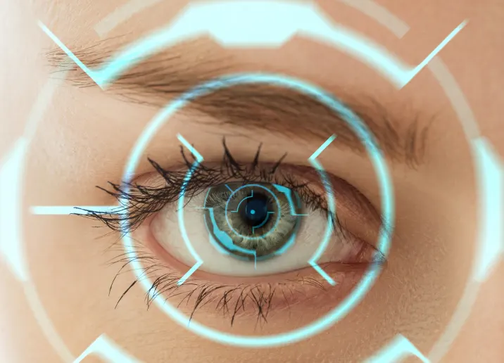 L’implantation de lentilles en Turquie