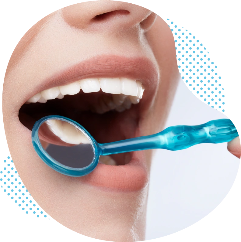 Nettoyage professionnel des dents