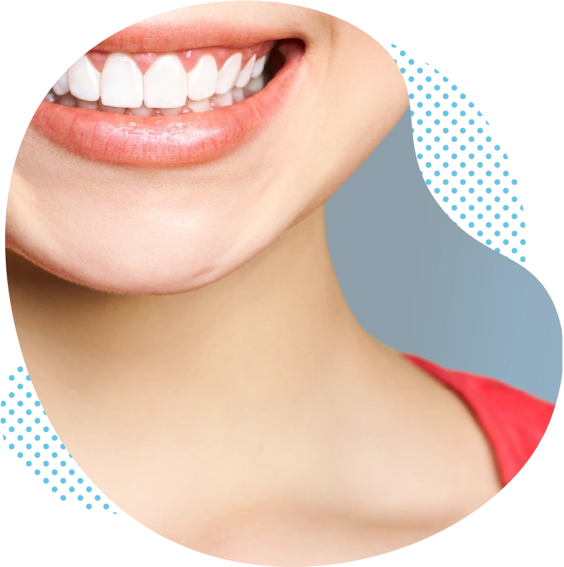 Le traitement de blanchiment pour vos dents – fonction & mode d’action