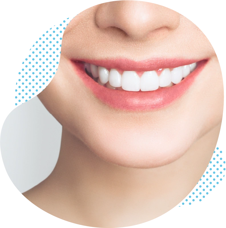 Le blanchiment dentaire- Découvrez une toute nouvelle sensation dentaire