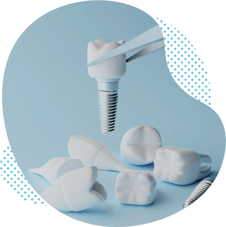 Comment entretenir correctement mon implant dentaire en Turquie ?